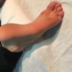 a person's foot with a needle sticking out of it