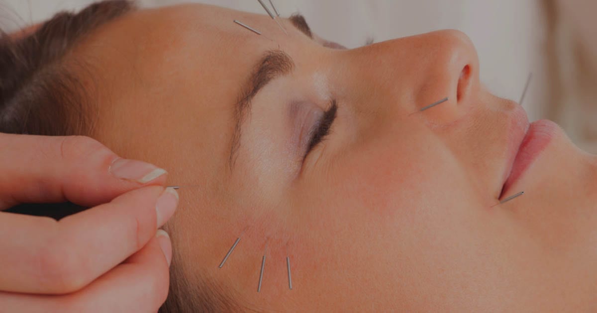 Can Acupuncture Help With Weight Loss? Won Institute