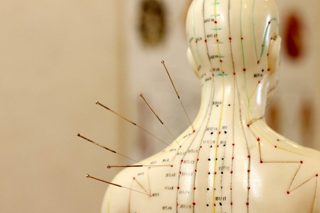 Acupuncture Chart Female
