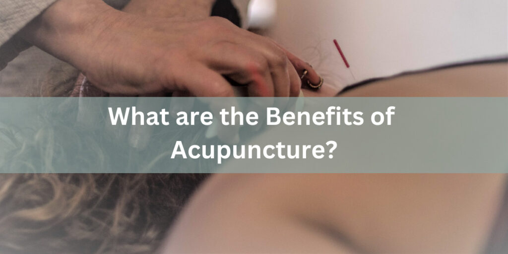 What are the Benefits of Acupuncture