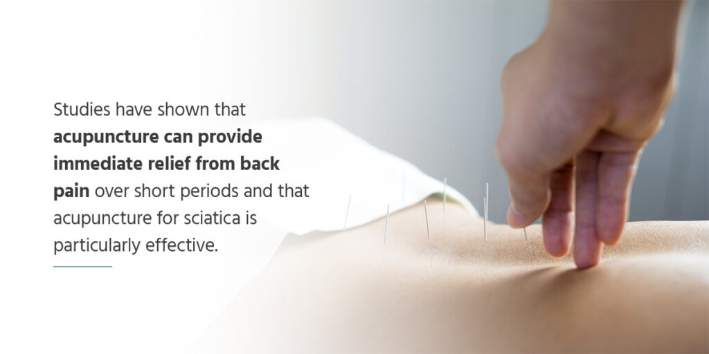 Can Acupuncture Relieve Sciatica Pain?